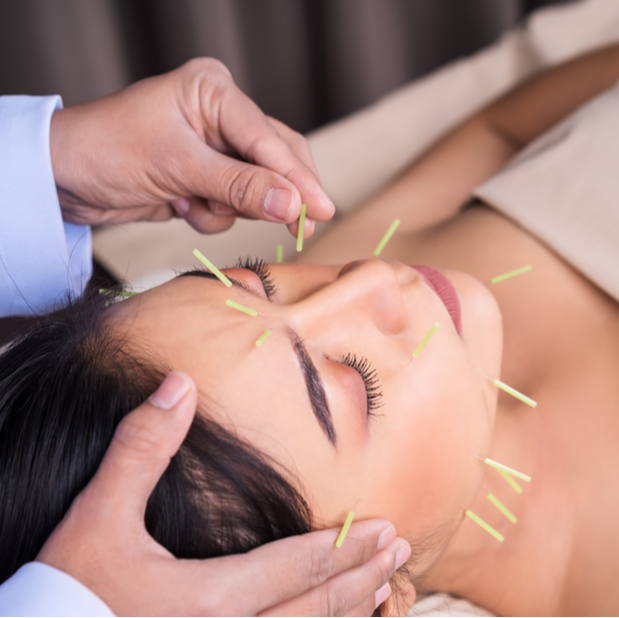 Acupuncture - Hillcrest Centre for Health
